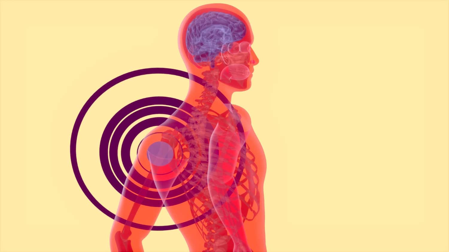 Online-Kurs: Fibromyalgie verstehen und bewältigen